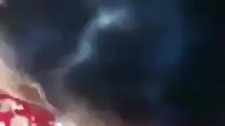 تجميل الوجه بعد اللسان من شاب هندي